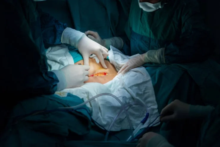 Laparoscopic Urology